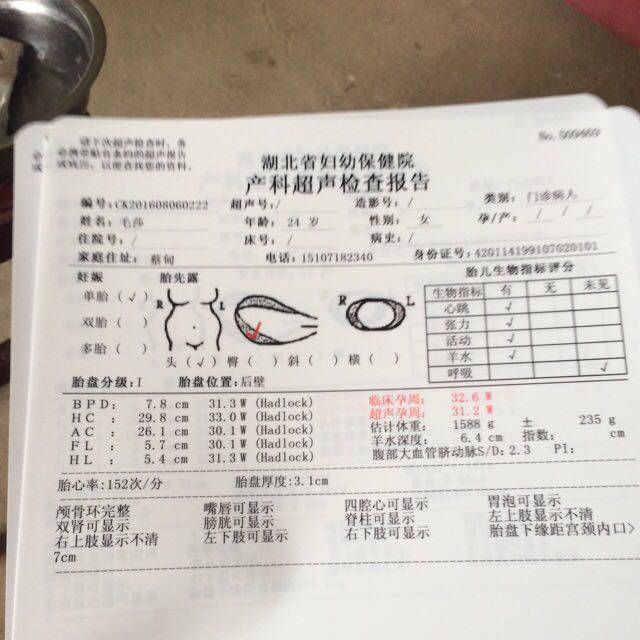 彩超_32周做小排畸显示宝宝左右上肢显示不清