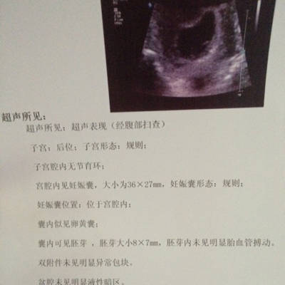 怀孕两个月多一点 昨天去医院做B超显示有胚芽