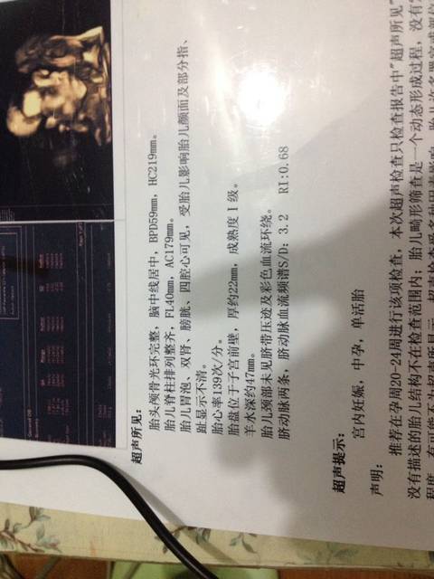 帮帮团_怀孕22周了 四维检查HC 和S\/D不在范