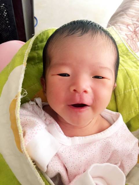 黄疸_宝妈们帮忙看看有谁知道,黄疸指数高于不