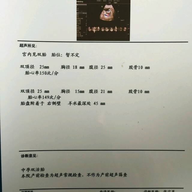 下男孩还是_我今天去检查 医生说是单卵双胎