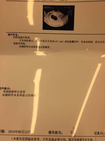 怀孕35天胚胎图片高清,怀孕40天胚胎图片高清 怀孕第51天未见胎心胎芽,医生说胚胎停止发育,可我不舍的流掉