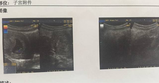 8周B超单,请大家帮忙看男女吧?