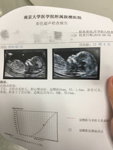 nt单可看男女,准确率90%