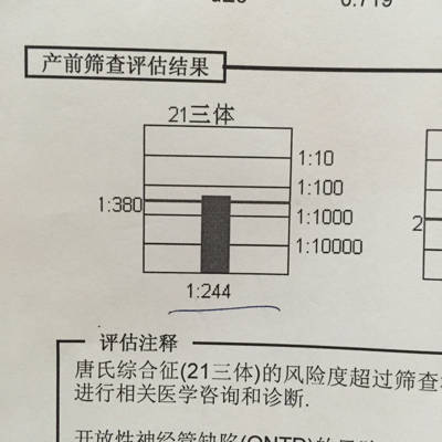 唐氏综合症风险率1:950 唐氏综合症 多少钱