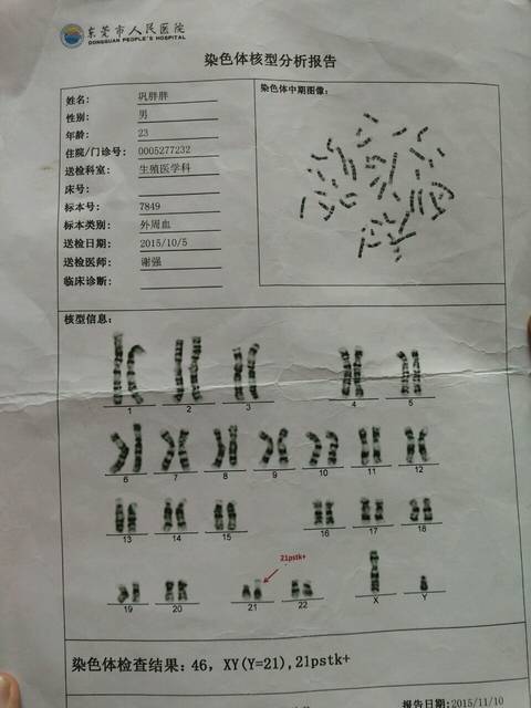 染色体异常的朋友生过的过来说说呀!_我老公有