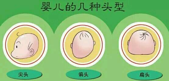 婴儿头型正常图_爸妈警惕宝宝睡姿影响发育长相但姿势不当易致