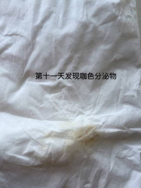 怀孕早期流褐色分泌物