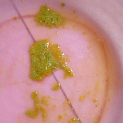 宝宝拉肚子今天有十六天了吃了药也不管用,是