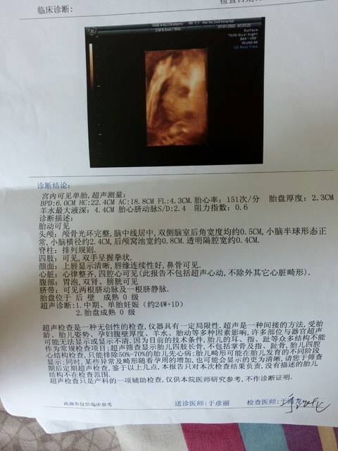 四维照_26周的时候做的四维照 孩子偏小 才显