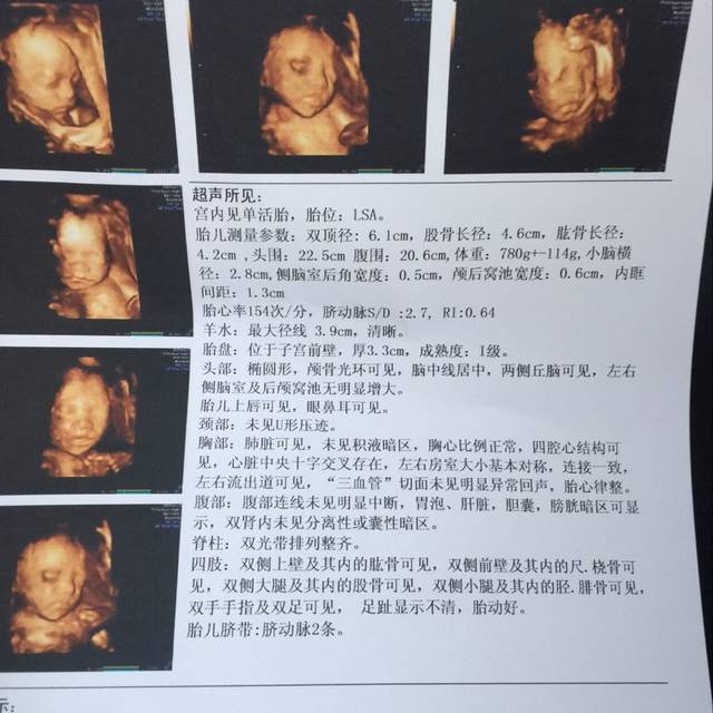 25周四维彩超报告单情况
