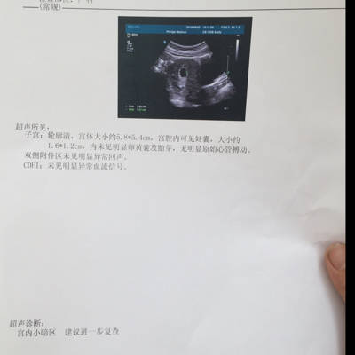 怀孕七周未见胎儿只有孕囊正常吗