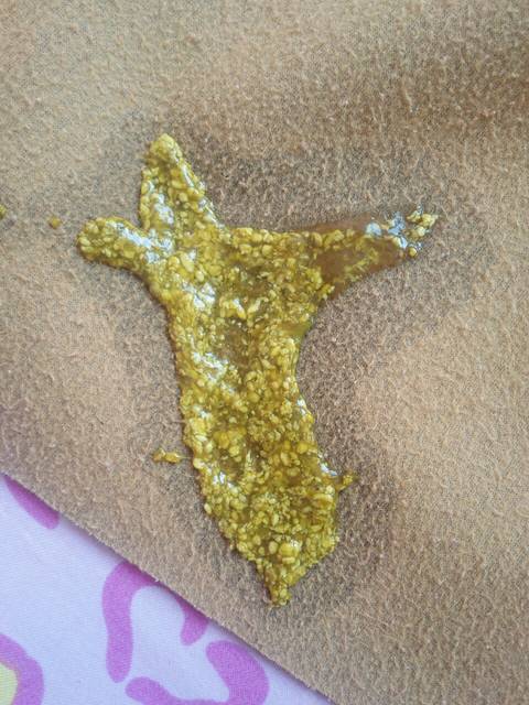 宝宝拉肚子老不好怎么办 _吃妈咪爱,思密达,蒙