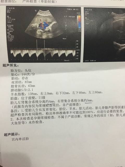 有懂B超单的宝妈么? …_孕32周双顶径87mm,