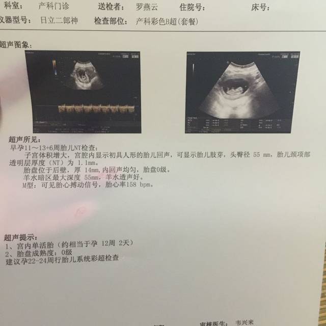 二胎,第一次孕检12周NT顺利,宝妈们来接宫内好