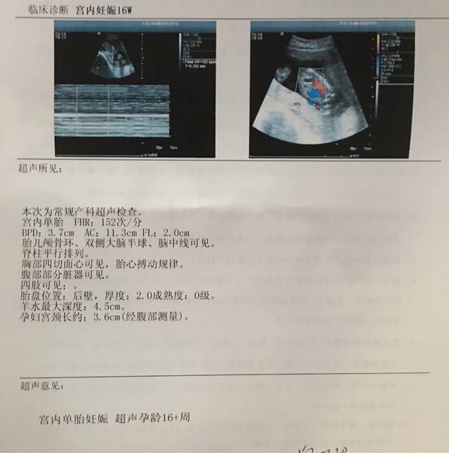 16W老大单,医生说可是girl_名字也是古风_宝微彩超名字女孩女生好听的信图片