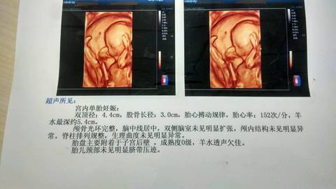 看肚型看男女_现在孕35周了，17周时bc看了说是女宝，可现_宝宝树