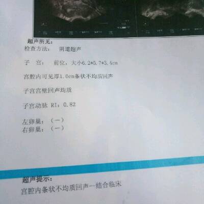 亲们这是我自然流产后照的阴超!好像还有点不干净