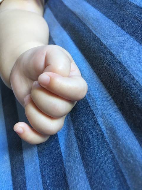宝宝皮肤怎么了_最近几日发现宝宝手指上脚上