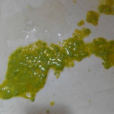 宝妈们我家宝宝的大便发绿色这是怎么回事啊?