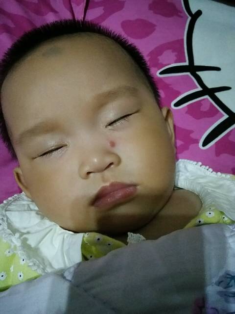 有哪位宝妈知道宝宝鼻子边上怎么长痘痘了,感