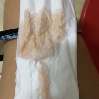 问答 怀孕期  育儿问题搜这裏 取消 最佳回答          羊水破了,赶紧