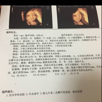 宝妈们帮忙看看第一胎四维彩超,男孩女孩能看出来吗?