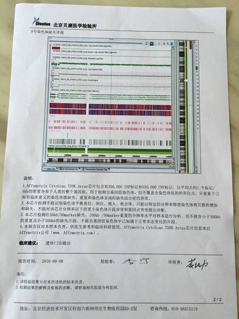 无创产前筛查出八号染色体微缺失,做了羊穿芯