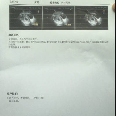 很意外去照个b超竟然是双胎,单卵双胎要注意点什么?到