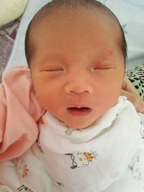 宝妈们_宝宝眼皮上红的,不知道怎么回事,出生