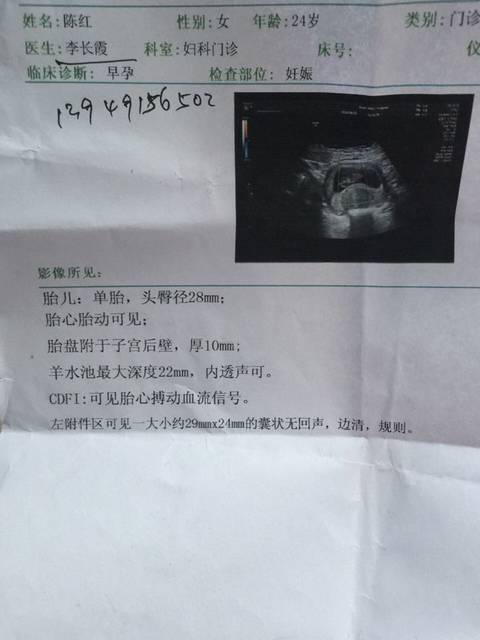 封闭抗体阳性染色体异常这次终好孕_去年结婚