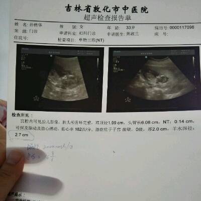 怀孕三个月胎头颅骨环完整,双顶径1.99cm,头臀