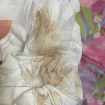 怀孕4周多各项检查都正常,就有褐色分泌物,医生让我在家躺着静养一个
