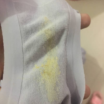 (有图)这是黄色还是褐色白带?用纸擦有黄褐色