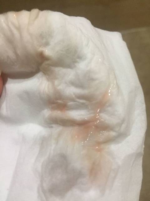 分泌物_怀孕一个月,流粉色分泌物,姐妹们有这