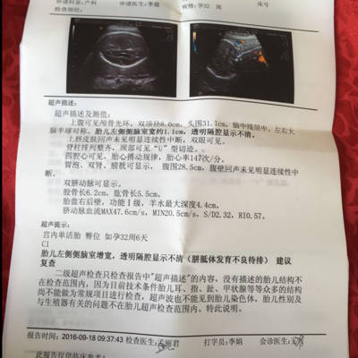 好心的医生,怀孕7个月,B超2级筛查时发现左侧