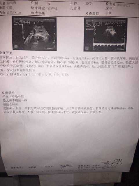 看得懂B超单子的都来看看,说说看男女