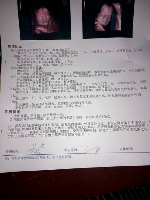 25周,四维彩超显示肠管扩张0.9cm严重吗_25周