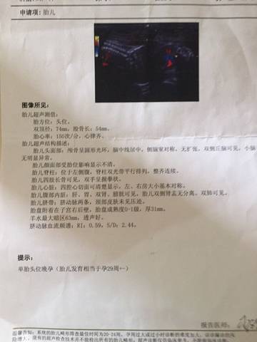 28周以上B超单数据才能。及及_可以发B超图