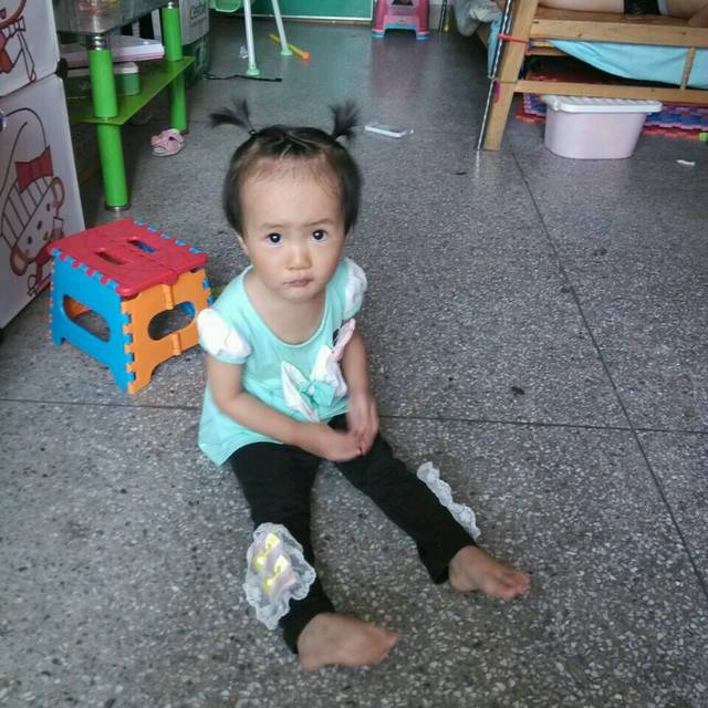 额头高,大额头,谁做过做个发际线调整_我就是