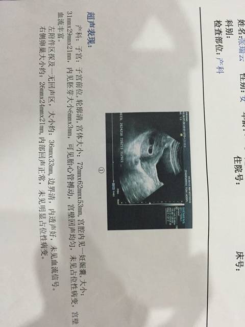 来还愿了_怀孕47天,之前有过两次胎停育,前几