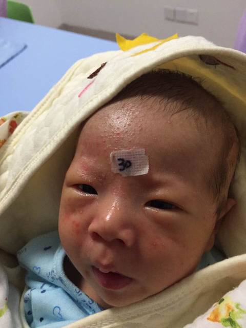 求助在苏州儿童医院住院5天脸上长的红点