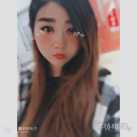 发际线调整_各位娘娘,有做过发际线调整的吗?