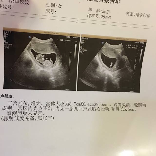 nt图看性别啦!有想看的速速甩图来…_研究好多天的nub 看_宝宝树