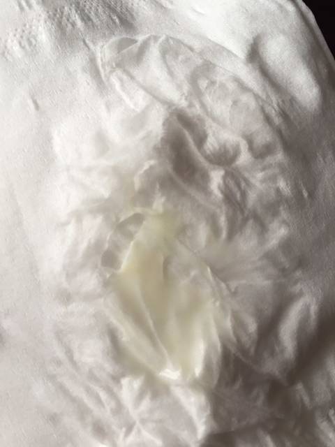 高位破水什么症状? 麻烦各位知道的说一下