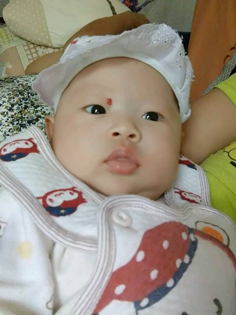 宝宝眼睛那里被我用指甲划破了,后来就起了一