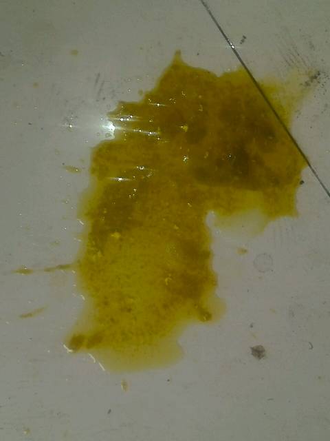 宝宝拉肚子老是不好,哪位有好方法,跪求