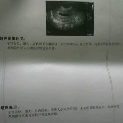 因为白带有褐色血丝 , 所以去了医院看医生了 正常已经9周了 , 昨天做了B照 , 孕囊大小如孕约7周 未见明显胚芽回声 医生考虑停育 。请问孩子还可以保吗?_育儿问答_宝宝树