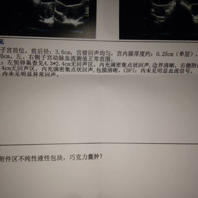 我有卵巢巧克力囊肿孕3个月破水流产(药流)9月11号流的9月22号清宫