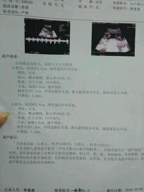 NT回来惊喜_7周B超一个胎囊,13周变成双胞胎